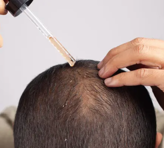 Phase 2 Study: Efficacy and Safety of PP405 for Hair Loss BY Pelage Pharmaceuticals