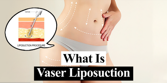 What is VASER Lipo?